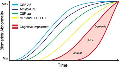Perivascular spaces as a potential biomarker of Alzheimer’s disease